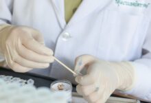 wbc در آزمایش مدفوع نشان دهنده چه بیماریهایی میباشد ؟ (2 نکته مهم)