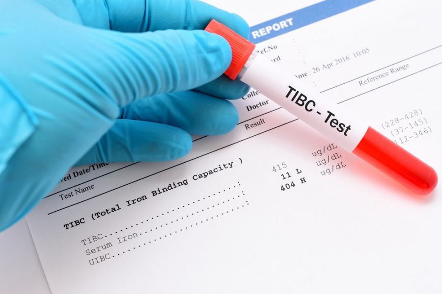 عوامل موثر در بالا و پایین شدن tibc در آزمایش خون چیست ؟ (2 نکته مهم)