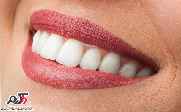 چگونه دندان‌هایی زیبا و بدون جرم داشته باشیم؟
