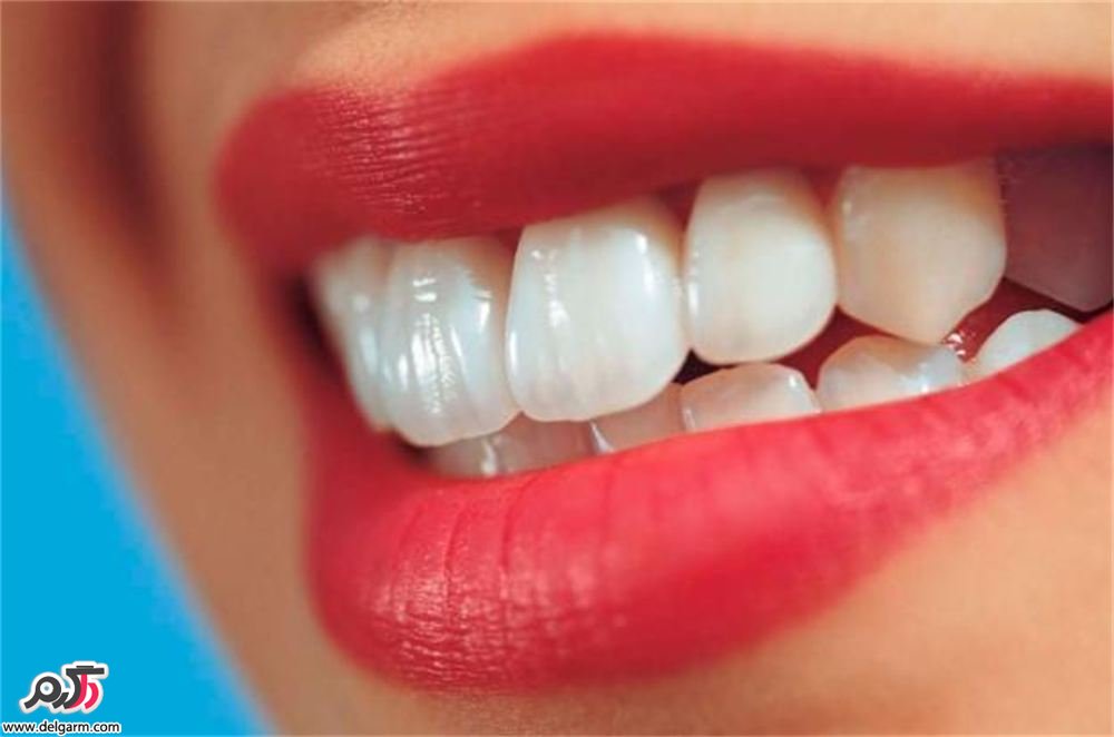 چگونه دندان های سفید و درخشانی داشته باشیم؟ (2 نکته مهم)