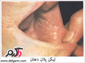بیماری‌های دهانی