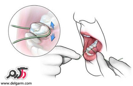 دلیل استفاده مرتب از نخ دندان