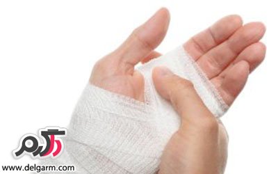 برطرف کردن جای سوختگی و تسکین درد سوختگی در خانه