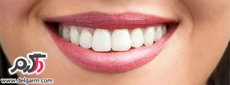داشتن دندان های زیبا و براق