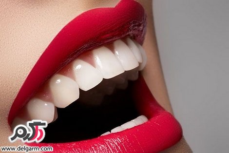 داشتن دندان های زیبا و براق