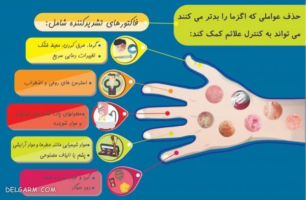 اگزما