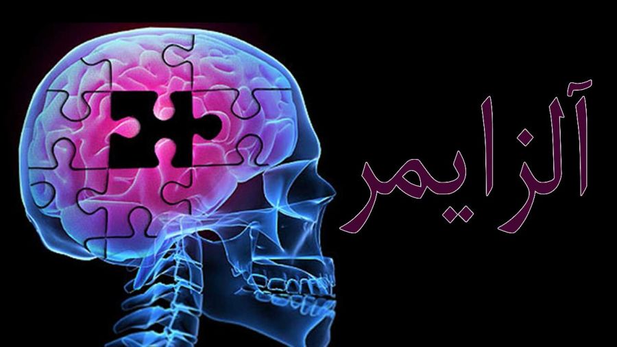 اطلاعات کامل در رابطه با داروی گالانتامین  (2 نکته مهم)