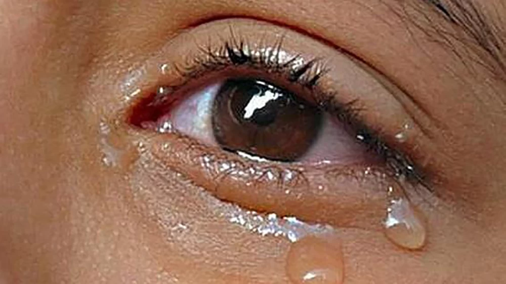 علت اصلی تولید اشک چشم