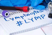 lymphocytes (lymph) در آزمایش خون و سطح نرمال آن (2 نکته مهم)