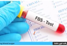 آزمایش قند خون ناشتا (FBS) باید چند باشد و چه شرایطی دارد ؟ (2 نکته مهم)