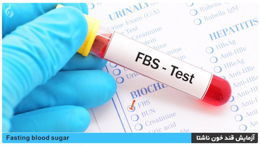 آزمایش قند خون ناشتا (FBS) باید چند باشد و چه شرایطی دارد ؟ (2 نکته مهم) آزمایش قند خون ناشتا (FBS) باید چند باشد و چه شرایطی دارد ؟ (2 نکته مهم)