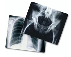 اشعه ایکس چیست و از اشعه ایکس کجا استفاده می شود (2 نکته مهم)