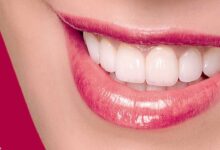 تقویت لثه؛گیاهان دارویی مناسب برای تقویت لثه و دندان ها (2 نکته مهم)