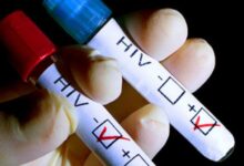 جواب آزمایش ایدز : تفسیر کامل نتایج آزمایش (HIV) ایدز (2 نکته مهم)