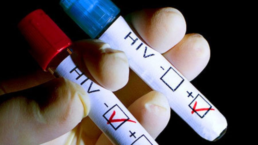 جواب آزمایش ایدز : تفسیر کامل نتایج آزمایش (HIV) ایدز (2 نکته مهم) جواب آزمایش ایدز : تفسیر کامل نتایج آزمایش (HIV) ایدز (2 نکته مهم)