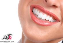 داشتن دندان های زیبا و براق (2 نکته مهم)