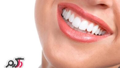 داشتن دندان های زیبا و براق (2 نکته مهم)