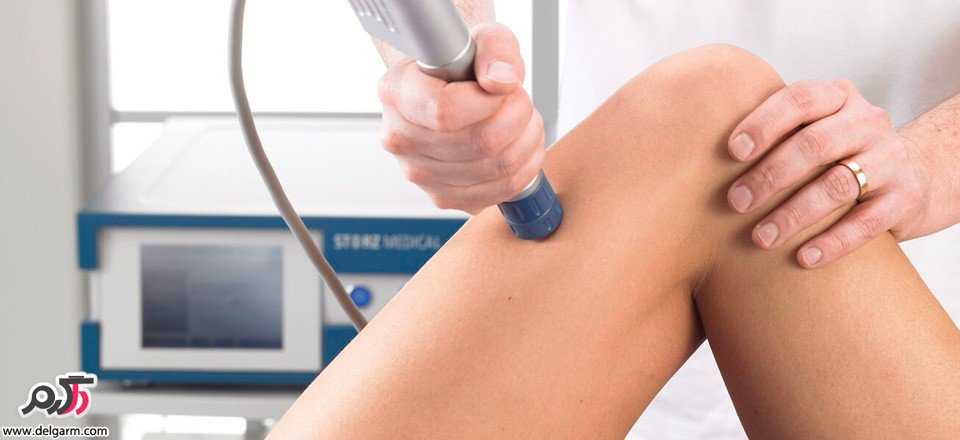 درمان سرپایی با شاک ویو تراپی shock wave therapy (2 نکته مهم) درمان سرپایی با شاک ویو تراپی shock wave therapy (2 نکته مهم)
