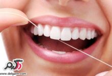 دلیل استفاده مرتب از نخ دندان (2 نکته مهم)