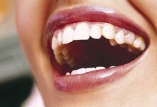 دندان های سفید و دهانی خوشبو با راهکارهای پیش رو (2 نکته مهم)