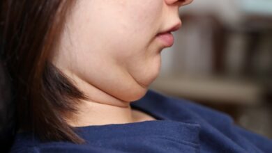 رژیم دکتر کرمانی: چگونه چاق شدن صورت را به حداقل برسانیم؟ (2 نکته مهم)