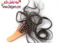طب سنتی ودرمان ریزش مو (2 نکته مهم)