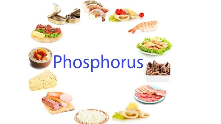علائم فسفر بالا در بدن چیست و چه خطراتی دارد ؟ (2 نکته مهم) علائم فسفر بالا در بدن چیست و چه خطراتی دارد ؟ (2 نکته مهم)