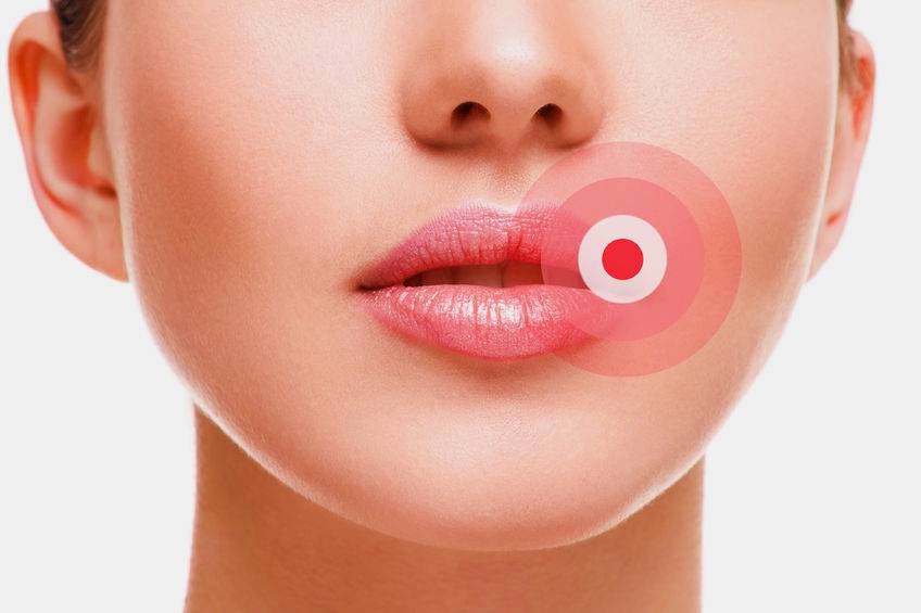 علت گزگز و سوزن سوزن شدن لب چیست؟ (2 نکته مهم)
