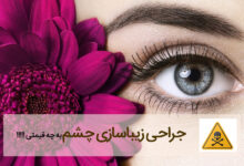 عوارض انواع عمل زیبایی چشم + ویدیو جراحی (2 نکته مهم)