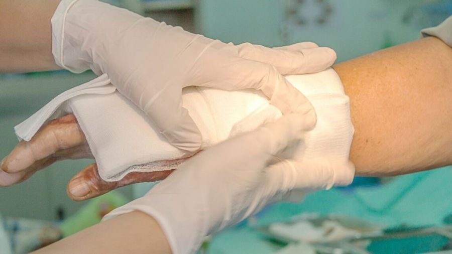 فواید استفاده از چسب بافتی برای ترمیم زخم ها (2 نکته مهم) فواید استفاده از چسب بافتی برای ترمیم زخم ها (2 نکته مهم)