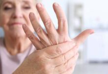 لیست بهترین فوق تخصص روماتولوژی در استان اصفهان (2 نکته مهم)