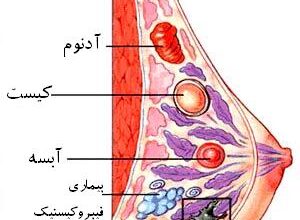 پستان در زنان و حقایقی در مورد آن (2 نکته مهم)