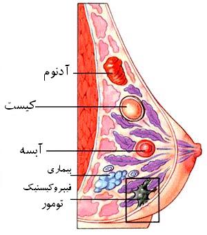 پستان در زنان و حقایقی در مورد آن (2 نکته مهم)