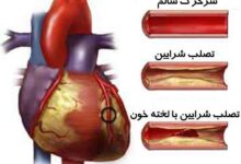 چربی هایی که برای قلب مفیدند (2 نکته مهم)