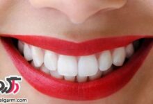 چگونه دندان هایتان را سفید کنید؟ (2 نکته مهم)