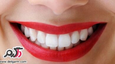 چگونه دندان هایتان را سفید کنید؟ (2 نکته مهم)