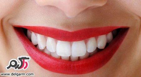 چگونه دندان هایتان را سفید کنید؟ (2 نکته مهم)