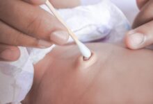 چگونه ناف را تمیز کنیم ؟ آموزش مرحله به مرحله تمیز کردن ناف (2 نکته مهم)