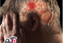 چگونه گی درآوردن لخته های خون از مغز  (2 نکته مهم)