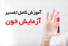 کامل ترین راهنمای خواندن آزمایش خون به زبان ساده (2 نکته مهم)
