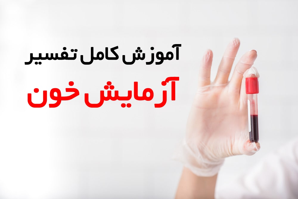 کامل ترین راهنمای خواندن آزمایش خون به زبان ساده (2 نکته مهم) کامل ترین راهنمای خواندن آزمایش خون به زبان ساده (2 نکته مهم)