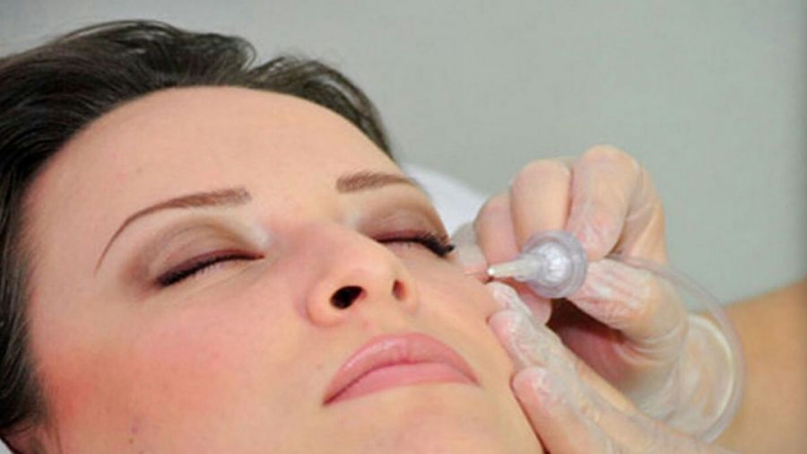 کربوکسی تراپی چیست؟ (2 نکته مهم) کربوکسی تراپی چیست؟ (2 نکته مهم)