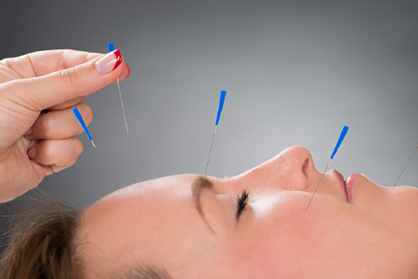 بهترین متخصص طب سوزنی در یزد + آدرس و تلفن